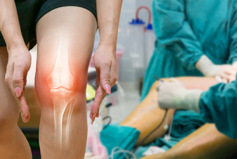 How Much Does a Total Knee Replacement Cost in India?